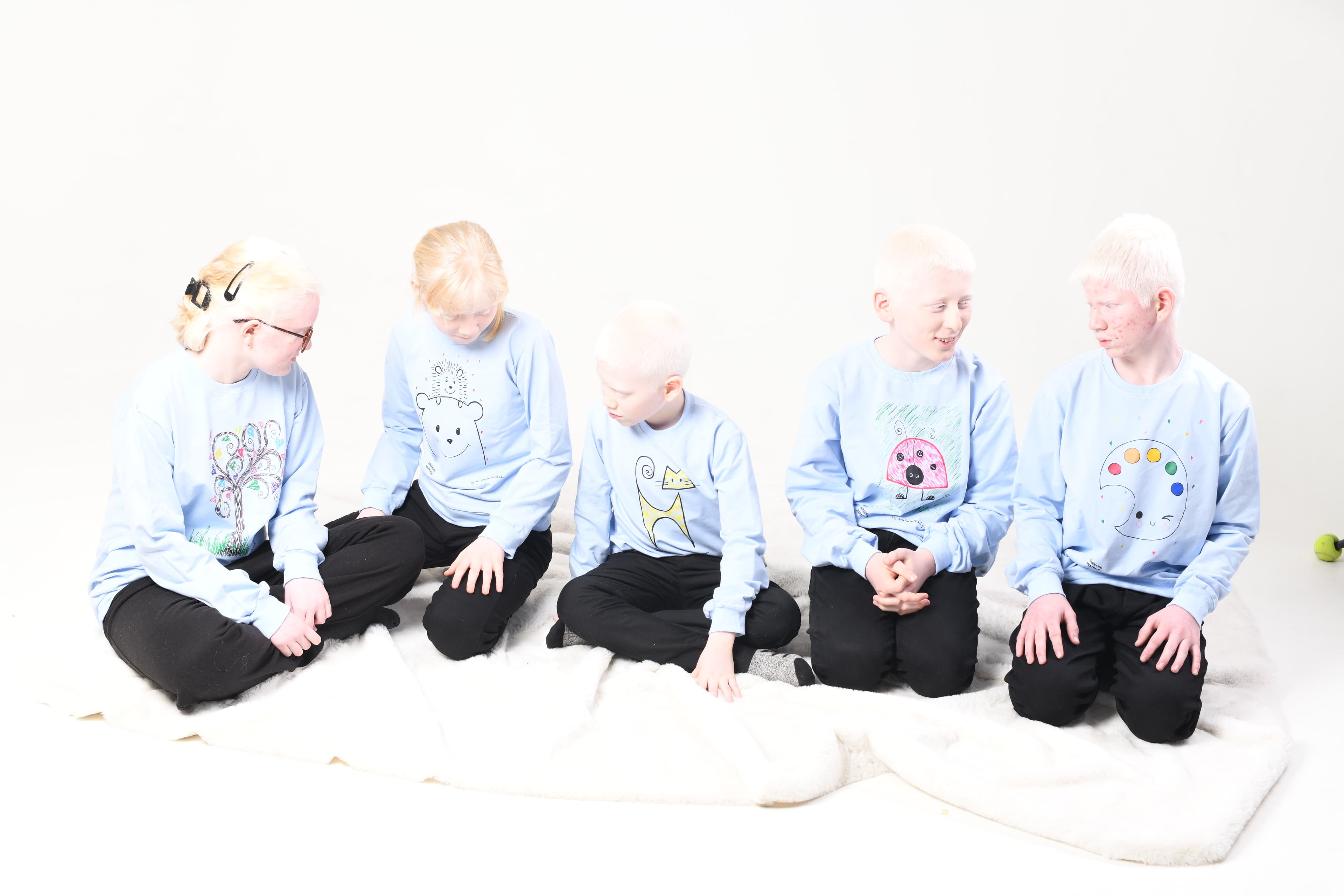 Не такие: Дети альбиносы